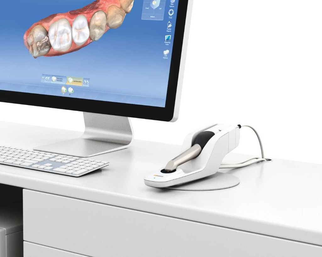 Stație CEREC – beneficii pentru medicul stomatolog